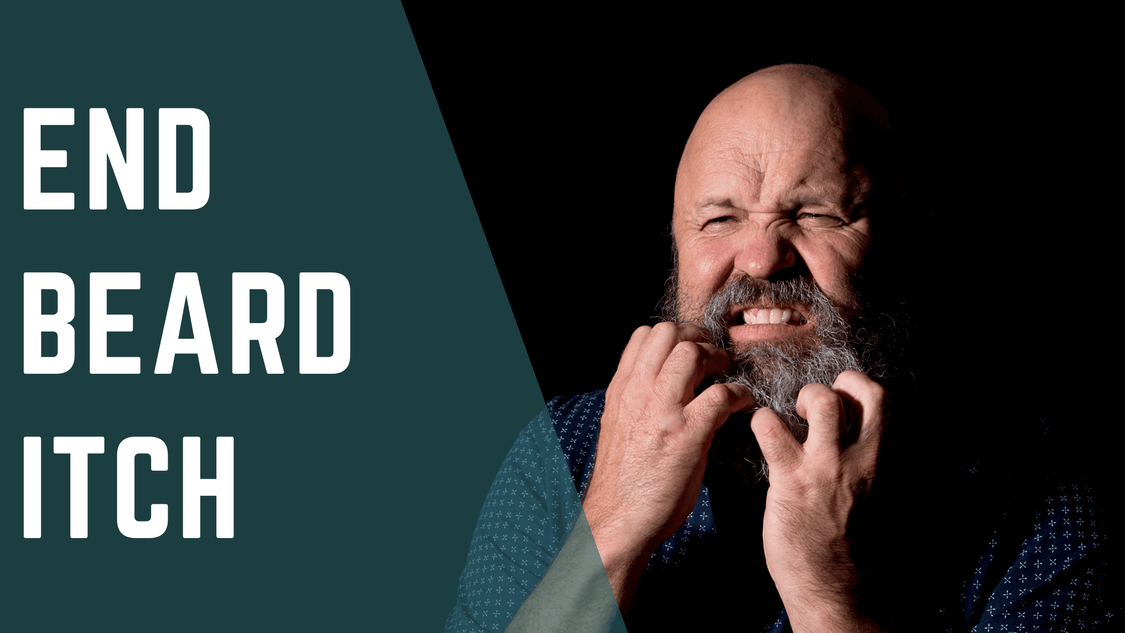end beard itch
